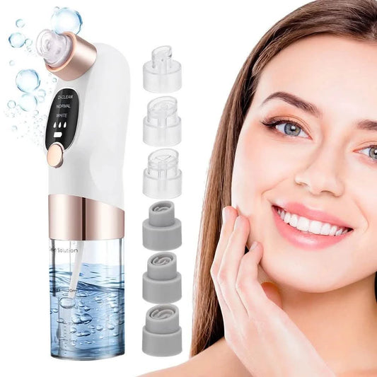 USB Blackhead Remover Pore Vacuum - Electric Facial Cleanser for Acne & Black Dots