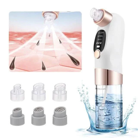 USB Blackhead Remover Pore Vacuum - Electric Facial Cleanser for Acne & Black Dots