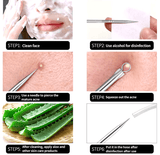 🔪 Acne Needle Set – 4pcs Double-Ended Stainless Steel Tool for Blackhead & Blemish Removal 🔪 Acne Needle Set – 4pcs Double-Ended Stainless Steel Tool for Blackhead & Blemish Removal