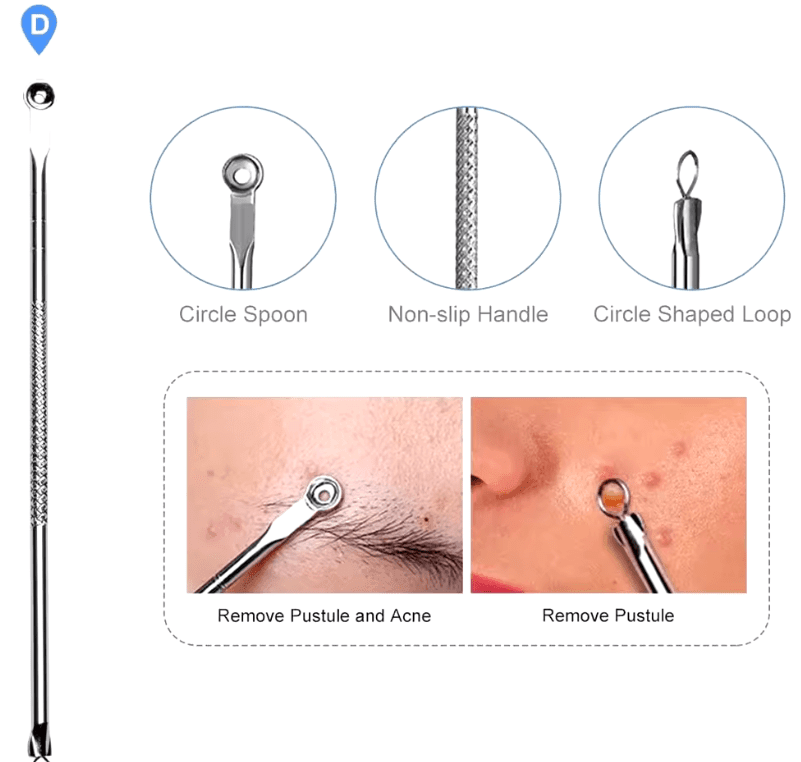 🔪 Acne Needle Set – 4pcs Double-Ended Stainless Steel Tool for Blackhead & Blemish Removal 🔪 Acne Needle Set – 4pcs Double-Ended Stainless Steel Tool for Blackhead & Blemish Removal