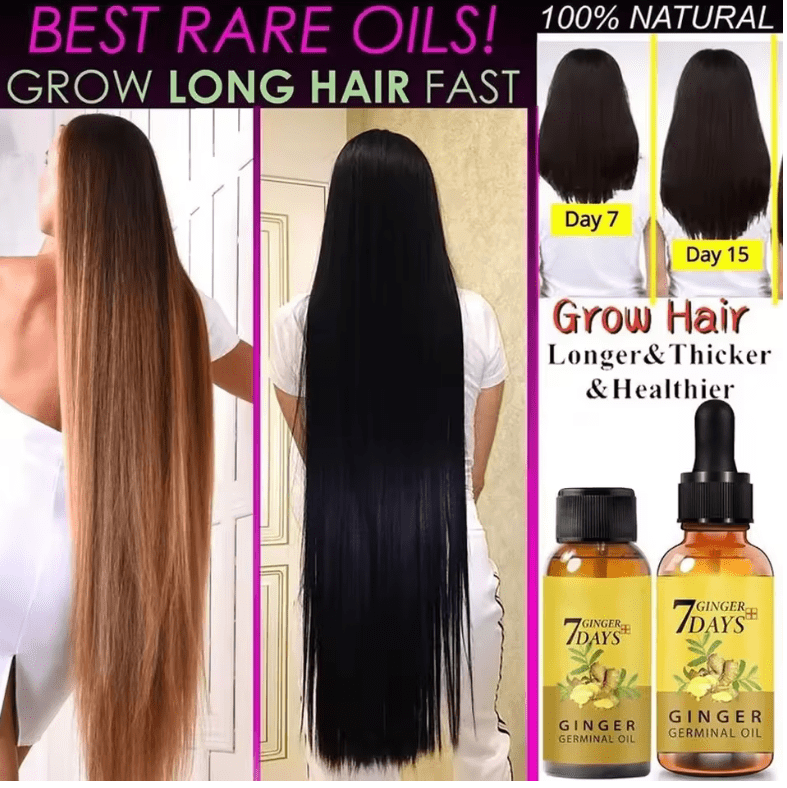 Hair Growth Serum – Anti Hair Loss Treatment for Faster Hair Regrowth – Strengthens Roots & Repairs Damaged Hair – Alopecia Support Formula