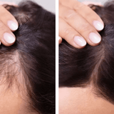 Hair Growth Serum – Anti Hair Loss Treatment for Faster Hair Regrowth – Strengthens Roots & Repairs Damaged Hair – Alopecia Support Formula