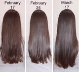 Hair Growth Serum – Anti Hair Loss Treatment for Faster Hair Regrowth – Strengthens Roots & Repairs Damaged Hair – Alopecia Support Formula