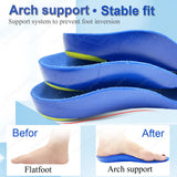 Orthotic Insoles for Flat Feet and High Arches