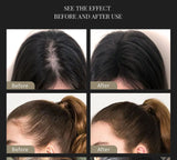 SEVICH Hair Building Fiber Set for Hair Loss Treatment