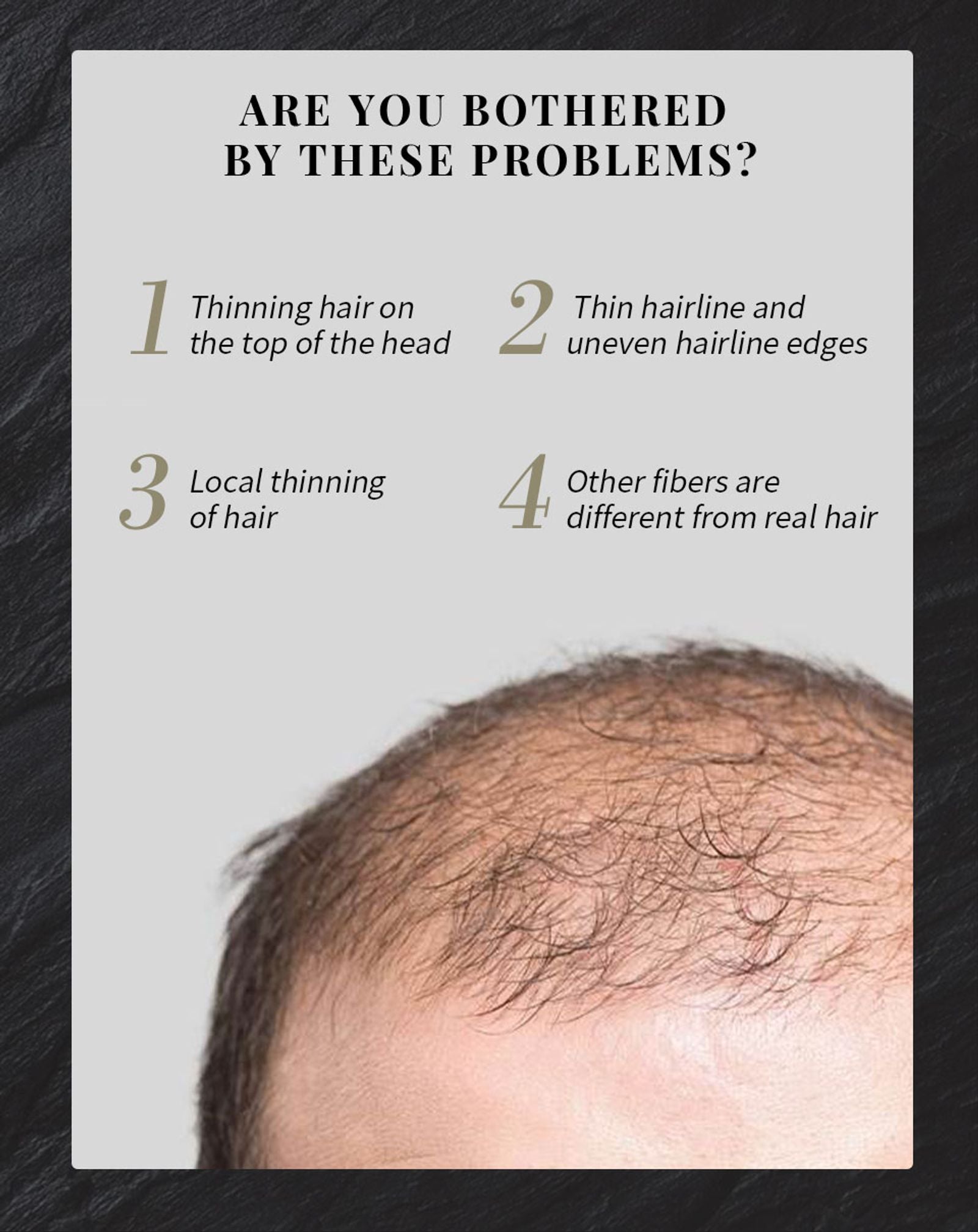 SEVICH Hair Building Fiber Set for Hair Loss Treatment